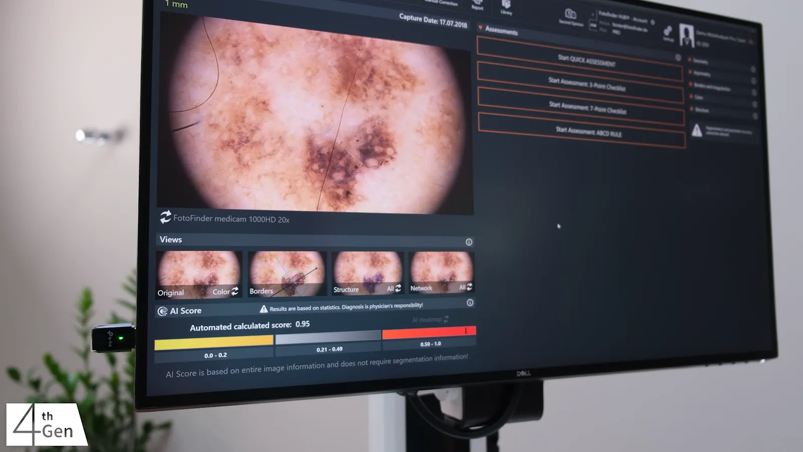Интерфейс Moleanalyzer pro из видео производителя